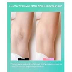 Bright Elegance BE-9020 IPL Lazer Epilasyon Cihazı